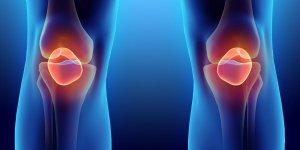 Douleurs aux genoux : 8 causes auxquelles on ne pense pas