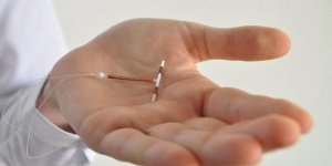 Sterilet (DIU) au cuivre : quels avantages ?
