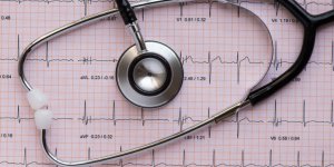 Tachycardie : un signe d-anemie ?