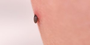 A quoi ressemble une piqure de tique ?