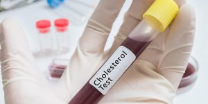 Differencier le bon et le mauvais cholesterol sur ses analyses