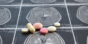 Ces deux medicaments associes pourraient prevenir le risque d’AVC