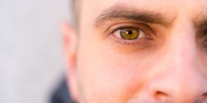 Yeux rouges : un signe de glaucome