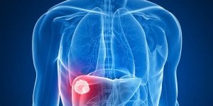Quels sont les cancers les plus dangereux ?