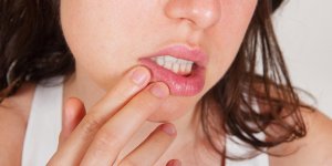 Bouton de fievre dans la bouche : comment le soigner ?
