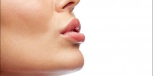Herpes buccal : quels sont les risques de contagion ?