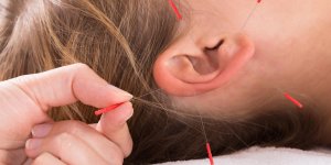Acouphenes : deroulement d-une seance d-acupuncture