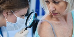 Cancer : les differents types de tumeur de la peau