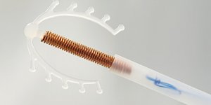 Peut-on etre enceinte avec un sterilet ?
