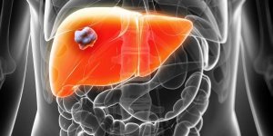 Cirrhose alcoolique : peut-on la soigner ? 