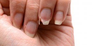 8 conseils pour rattraper des ongles abimes 
