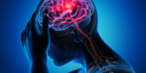 AVC : avoir eu un traumatisme cranien augmente vos risques !