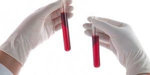 Cancer du sang : 3 symptomes a reperer