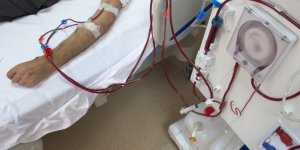 Insuffisance renale : les effets secondaires de la dialyse