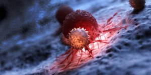 Cancer : un medicament guerit 100 % des patients dans un essai clinique 