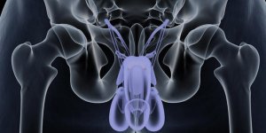 Torsion des testicules : une cause possible de sterilite masculine
