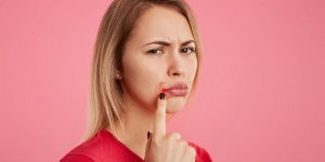L-homeopathie peut-elle etre efficace contre un herpes labial ?