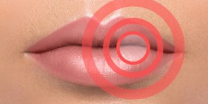 Bouton de fievre : une contagion virale