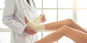 Cheville : les symptomes de la fracture bimalleolaire