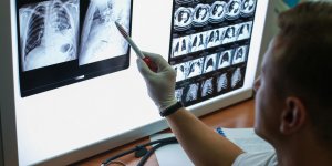 Pneumonie : les bacteries en cause dans cette infection