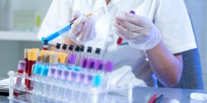 Bon cholesterol : le taux optimal
