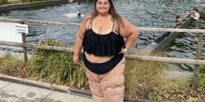 Helene, 38 ans, atteinte de lymphoedeme : “De la lymphe coulait par des orifices de mes jambes”