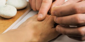 Point Ling Gu : soulager la sciatique par l-acupuncture