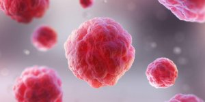 Cancer du sein : le gene a l-origine de la propagation des metastases decouvert ? 