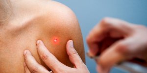 Grain de beaute rouge : un signe de cancer de la peau ?