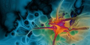 Cancer : une cause de septicemie ?