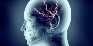 Œdeme cerebral : quelles sequelles ?