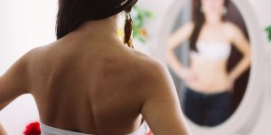 Melanome nodulaire : a quoi ca ressemble ? 