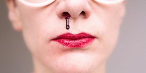 Saignement de nez : un symptome de cancer du sang ?