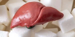 Steathose hepatique : reduire le sucre pendant 8 semaines aide le foie