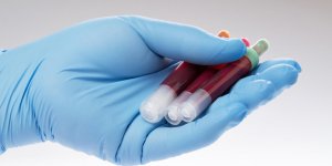 Gamma GT : quel est le taux normal ?