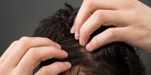 Quelles sont les mycoses contagieuses ?