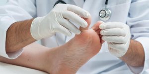 Panaris profond : 2 astuces pour le traiter