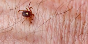 Anaphylaxie : la complication mortelle causee par une morsure de tiques