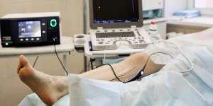 Operation des varices : la meilleure saison pour la faire