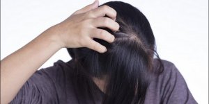 Squame du cuir chevelu : un signe de maladie ?