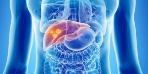 Cancer du foie : des aliments a eviter ?