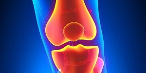 Arthrose : des injections de graisse qui reduisent la douleur