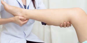 Œdeme des jambes : un signe de cancer du rein ?