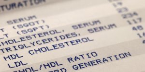 Cholesterol : les conseils d-une cardiologue pour le reduire rapidement apres les fetes
