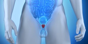 PSA : ce test de depistage du cancer de la prostate ferait plus de mal que de bien