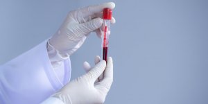 Coronavirus : les groupes sanguins A et AB, plus a severement touches