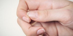 Pourquoi mes ongles se dedoublent ?