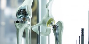 Fracture du col du femur : peut-on en mourir ?