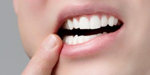 Mycose buccale apres une fellation, c-est possible ?