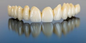 Une prothese dentaire peut-elle etre provisoire ?